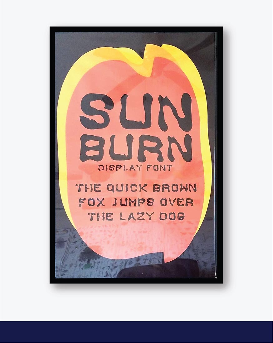 sunburn